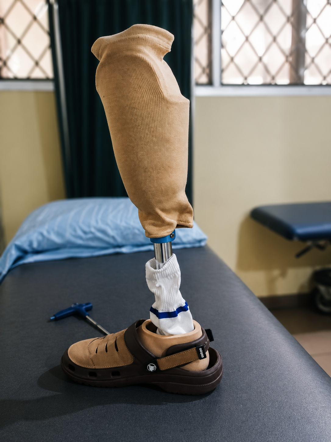 Prosthetic Limb